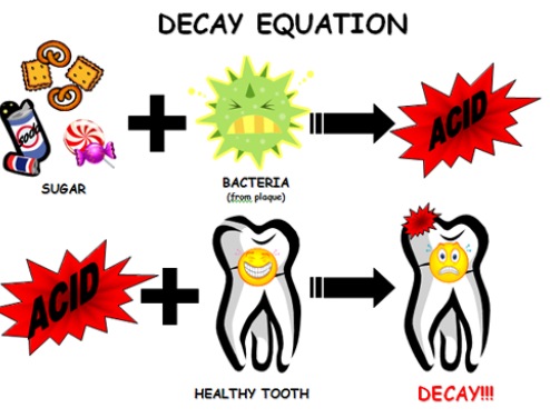 tooth decay eqaution